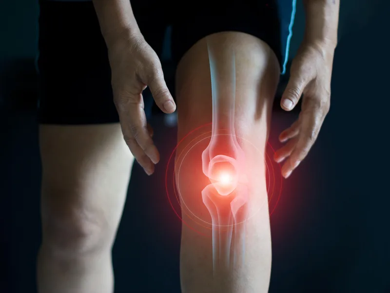 How Restore24 Chiropractic treats arthritis in Overland Park